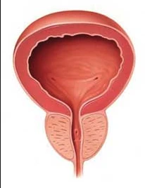 Schéma illustrant une prostate de volume habituel